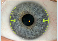 Децентрация оптической оси глаза