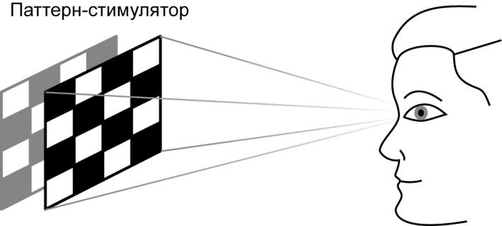Паттерн-электроретинограмма