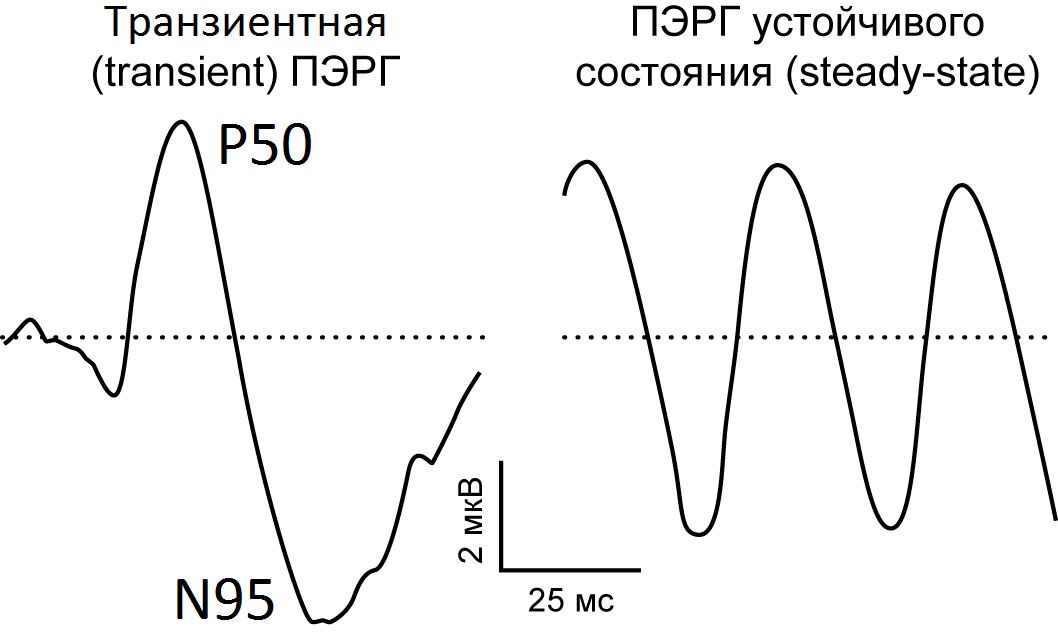 Паттерн-электроретинограмма