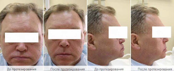 Пример из личной практики центра «Диал-Дент»