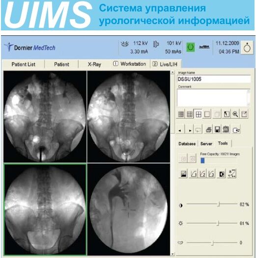 UIMS - Система управления урологической информацией