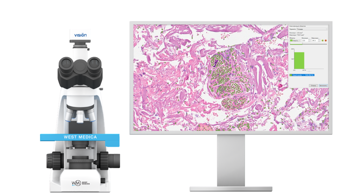 Автоматические сканирующие системы
