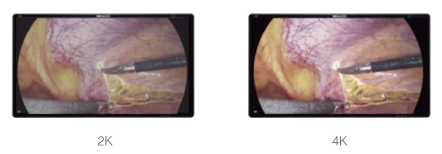 Сверхвысокая разрешающая способность и высокая яркость Сверхвысокая разрешающая способность и высокая яркость