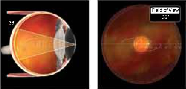 Volk 1 Single-Use Flat Standard Volk 1 Single-Use Flat Standard