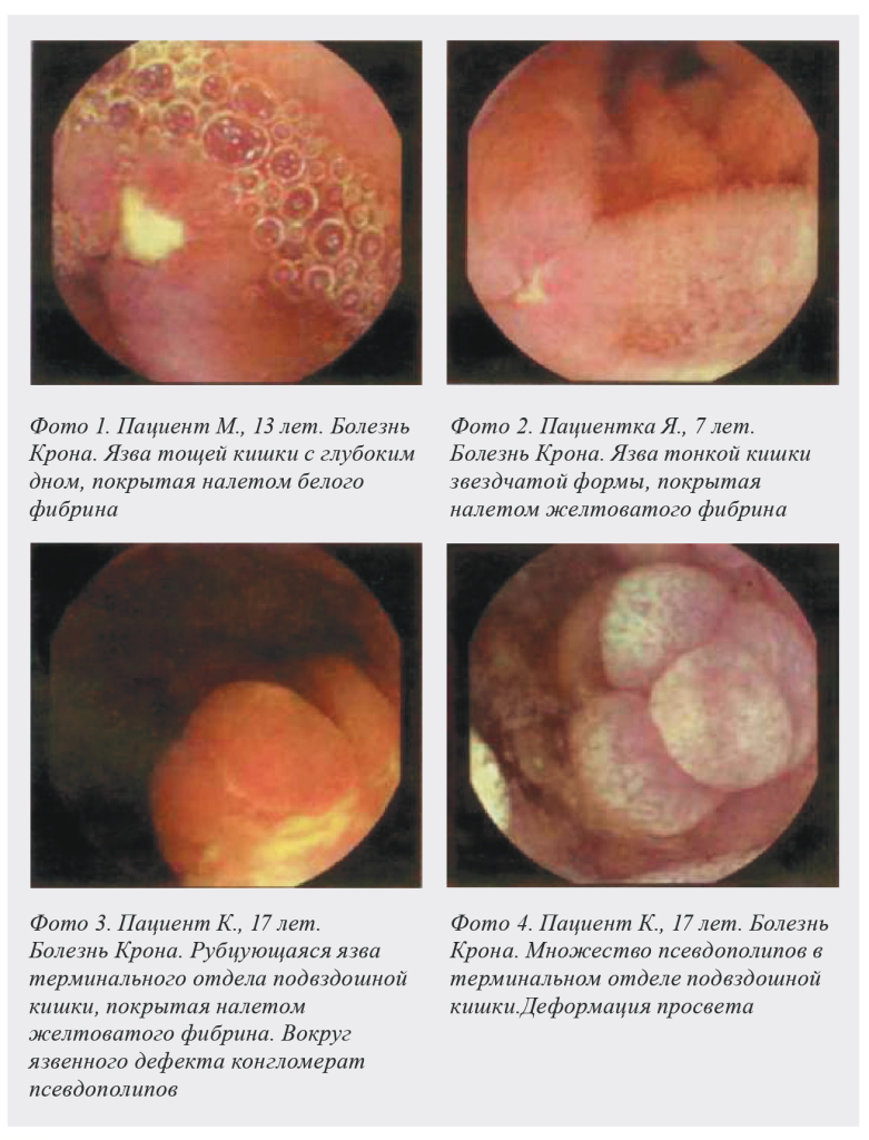 Клинические клучаи