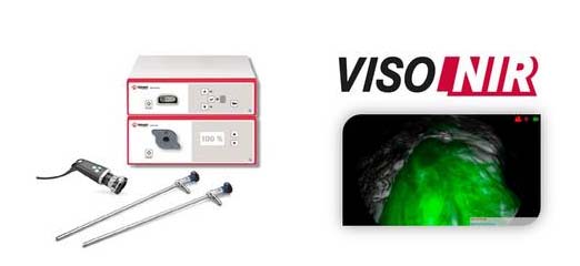 Флуоресцентная визуализация в жесткой эндоскопии VISO NIR Tekno Medical (Германия)