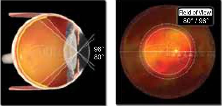 Super 66 Volk Super 66 Volk