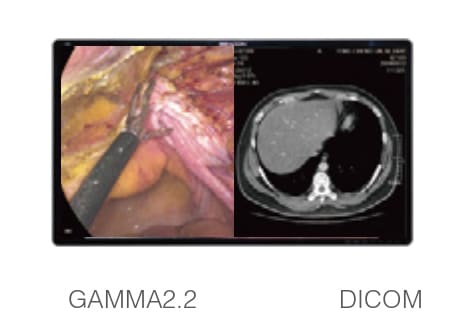 GAMMA-монитор с разделенным экраном GAMMA-монитор с разделенным экраном