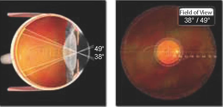 Digital ClearMag Digital ClearMag