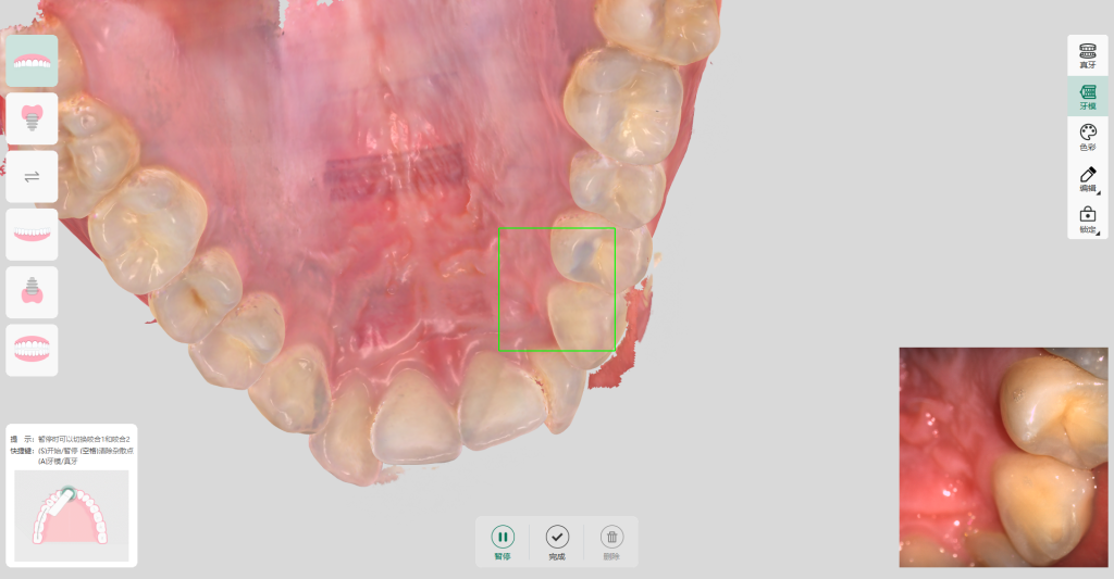 Интерфейс mOS MyScan Meyer Интерфейс mOS MyScan Meyer
