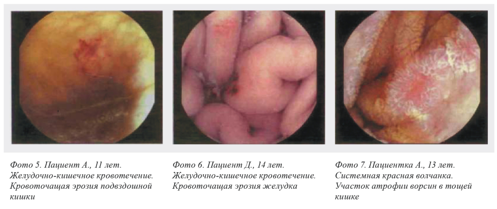 Клинические случаи