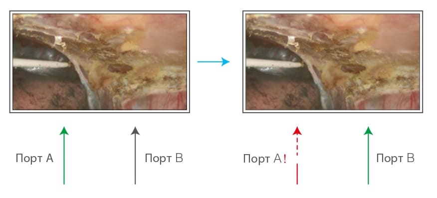 Быстрое переключение в режм тревоги Быстрое переключение в режм тревоги