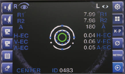 Периферическая кератометрия Периферическая кератометрия