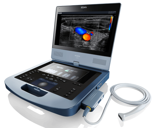 УЗИ аппарат портативный Edan Acclarix AX8