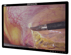 Хирургический монитор сверхвысокой чёткости Beacon S5583P(L) 55"