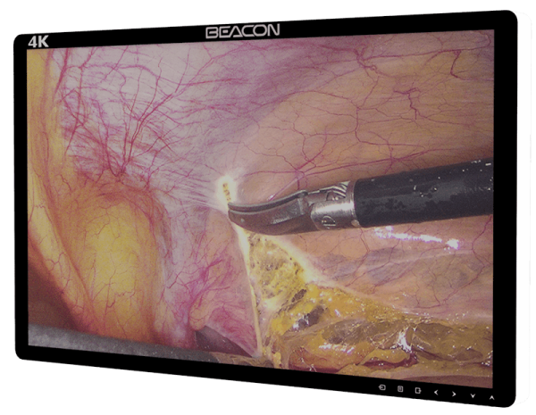 Хирургический монитор сверхвысокой чёткости Beacon S2785P 27"