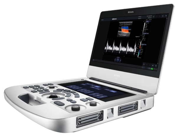 УЗИ аппарат портативный Edan Acclarix AX3