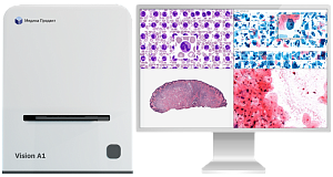 Цифровой сканер микропрепаратов 3DHISTECH Pannoramic Desk (Венгрия)