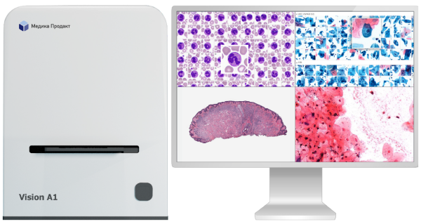 Автоматическая сканирующая система Медика Продакт Vision A1 (Россия)